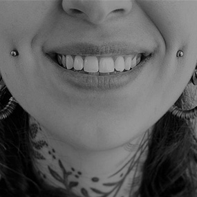 Close-up of a healed ear piercing