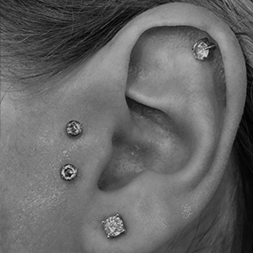 Dermal anchor surface piercing